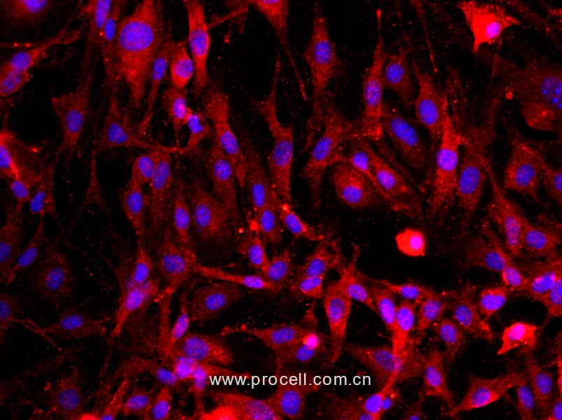 大鼠海綿體內(nèi)皮細(xì)胞