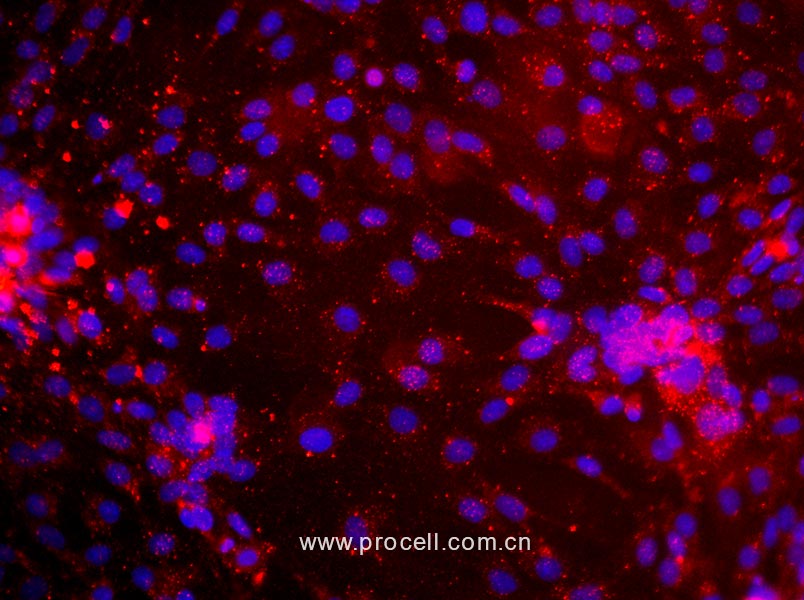 大鼠真皮微血管內(nèi)皮細(xì)胞